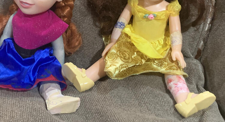 Image shows most of two dolls with Anna's foot bandaged and Belle's leg and both arms. 